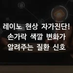 레이노 현상 자가진단! 손가락 색깔 변화가 알려주는 질환 신호